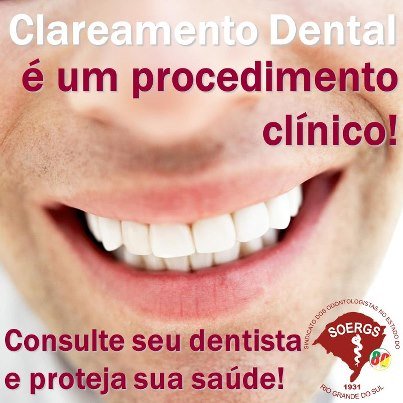 Alerta Clareamento Dental